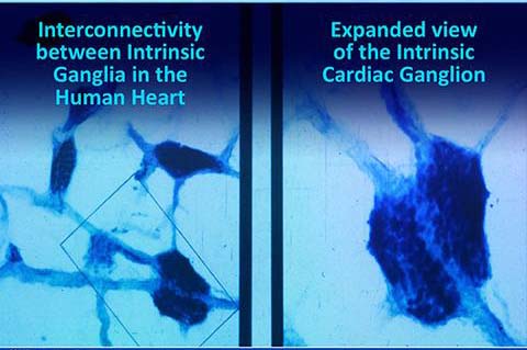 Un piccolo cervello nel cuore